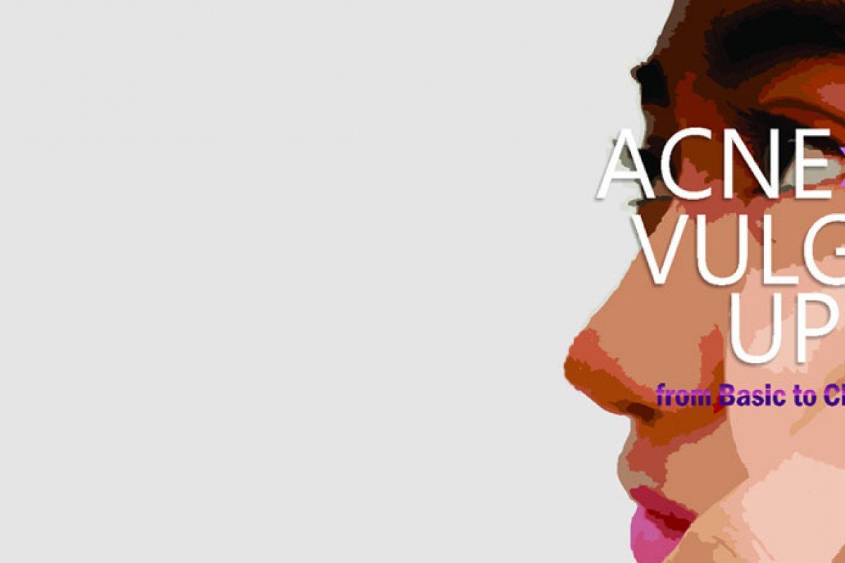 Acne Vulgaris Update