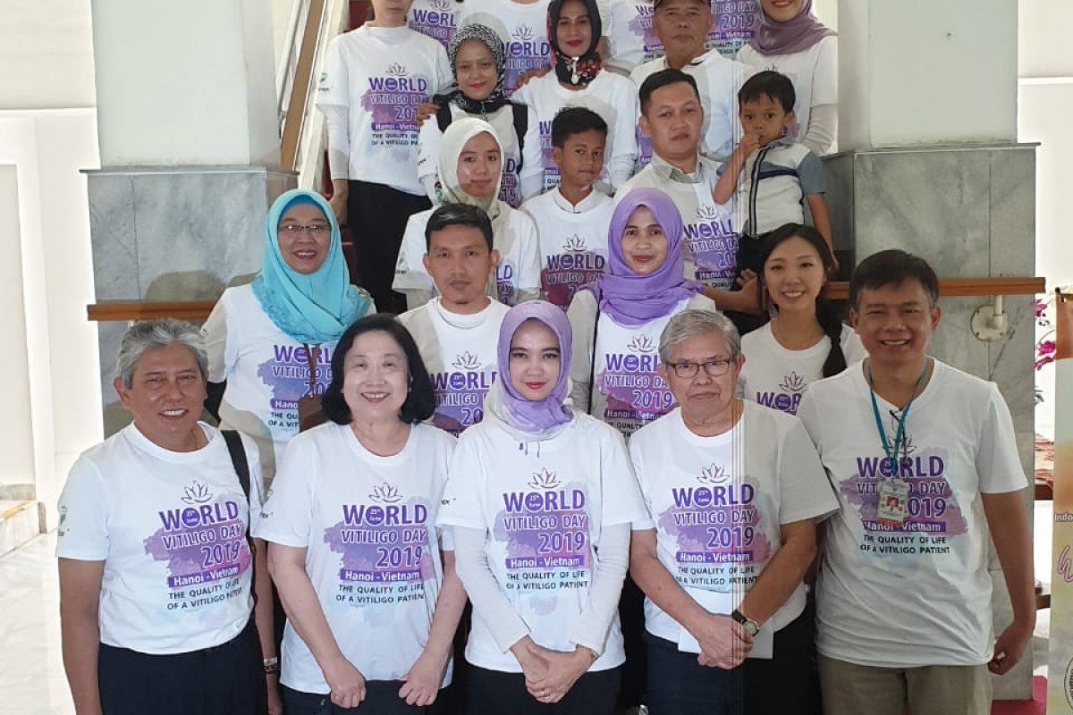 Peringatan World Vitiligo Day Pertama di Indonesia oleh PERDOSKI