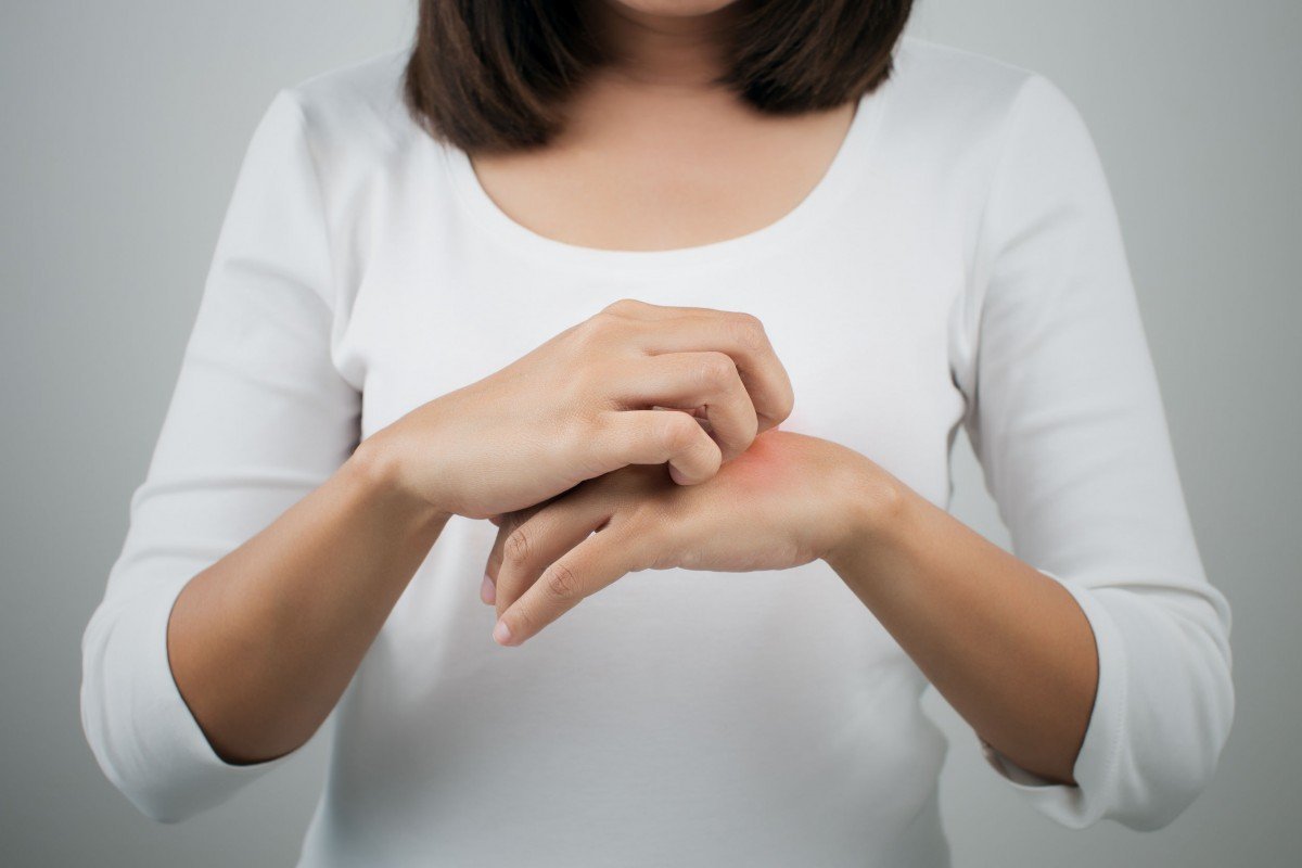 Gatal saat Stres? Bisa Jadi Gejala Neurodermatitis