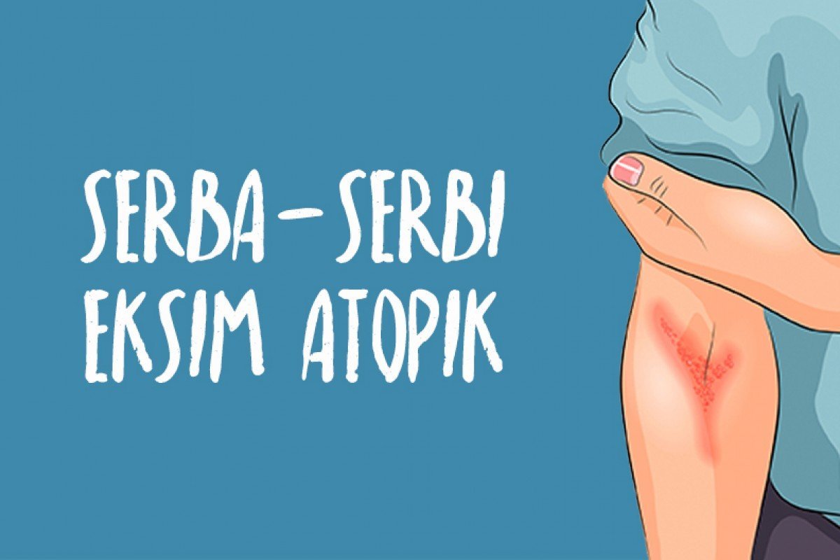 INFOGRAFIS: Serba Serbi Eksim Atopik