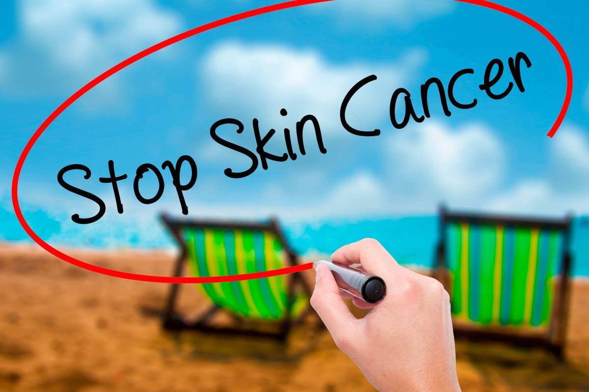 Sering Lupa Pakai Sunscreen Bisa Sebabkan Kanker Kulit Karsinoma Sel Basal